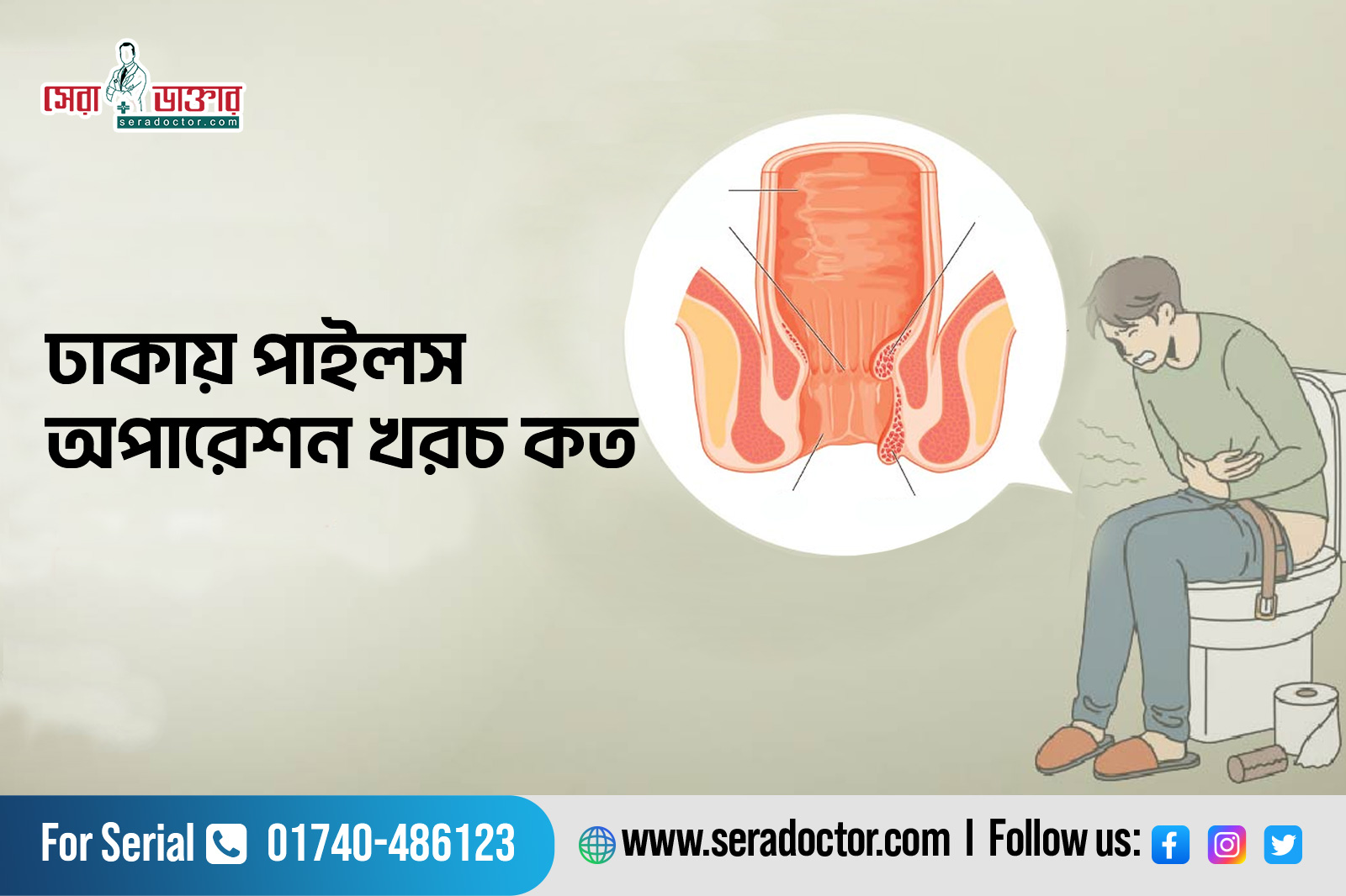 পাইলস অপারেশন খরচ, Piles